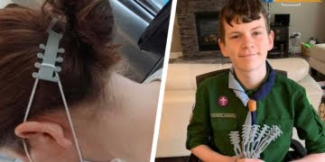 Quinn Callander, un jeune canadien a fabriqué un « protège-oreilles » pour soulager la douleur des soignants qui doivent porter un masque toute la journée.